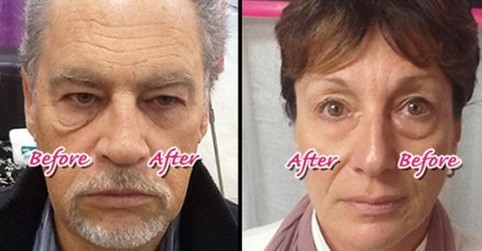 Instantly Ageless Before and After Pictures
